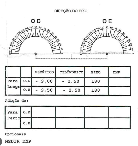 receita de óculos